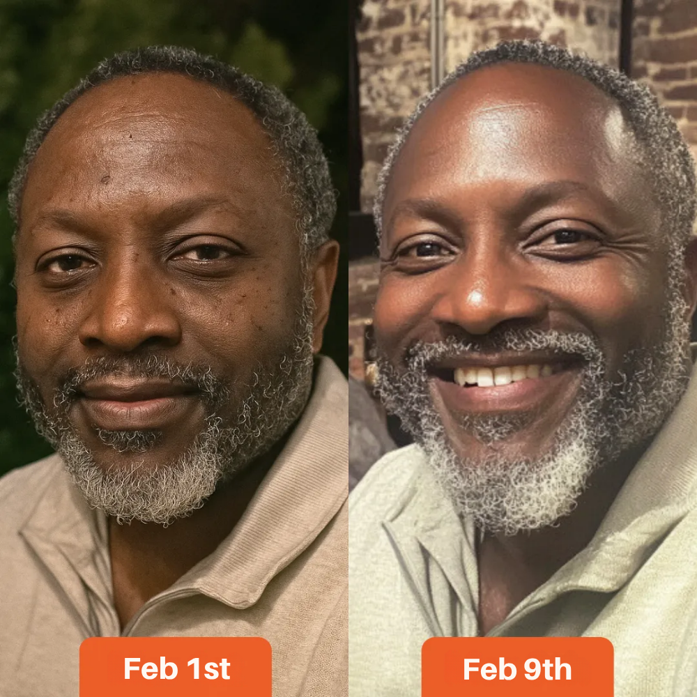 Anti-Acne & Dark Spots African Soap